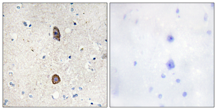 IGFBP3 Antibody - Immunohistochemistry analysis of paraffin-embedded human brain, using IGFBP-3 (Phospho-Ser183) Antibody. The picture on the right is blocked with the phospho peptide.