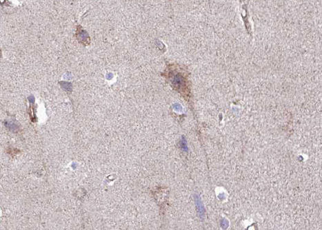 IGFBP3 Antibody - 1:100 staining human brain tissue by IHC-P. The tissue was formaldehyde fixed and a heat mediated antigen retrieval step in citrate buffer was performed. The tissue was then blocked and incubated with the antibody for 1.5 hours at 22°C. An HRP conjugated goat anti-rabbit antibody was used as the secondary.