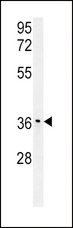 IGFBP3 Antibody - IGFBP3-S183 western blot of mouse stomach tissue lysates (15 ug/lane). The IGFBP antibody detected IGFBP protein (arrow).