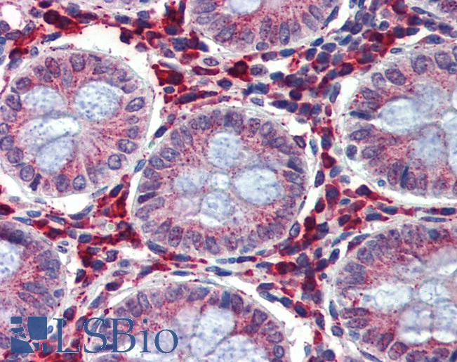 IGFBP4 Antibody - Anti-IGFBP4 antibody IHC of human colon. Immunohistochemistry of formalin-fixed, paraffin-embedded tissue after heat-induced antigen retrieval. Antibody concentration 5 ug/ml.  This image was taken for the unconjugated form of this product. Other forms have not been tested.