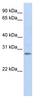 IGFBP4 Antibody - Western analysis of fetal brain lysate.  This image was taken for the unconjugated form of this product. Other forms have not been tested.