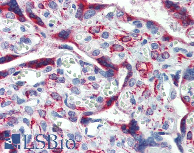 IGFBP4 Antibody - Anti-IGFBP4 antibody IHC of human placenta. Immunohistochemistry of formalin-fixed, paraffin-embedded tissue after heat-induced antigen retrieval. Antibody concentration 5 ug/ml.  This image was taken for the unconjugated form of this product. Other forms have not been tested.