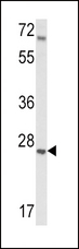 IGFBP4 Antibody - Western blot of IGFBP4 Antibody in mouse lung tissue lysates (35 ug/lane). IGFBP4 (arrow) was detected using the purified antibody.