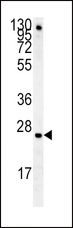 IGFBP4 Antibody - IGFBP4 Antibody western blot of mouse lung tissue lysates (15 ug/lane). The IGFBP4 antibody detected IGFBP4 protein (arrow).