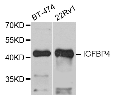 IGFBP4 Antibody - Western blot analysis of extract of various cells.