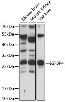 IGFBP4 Antibody - Western blot analysis of extracts of various cell lines, using IGFBP4 antibody at 1:1000 dilution. The secondary antibody used was an HRP Goat Anti-Rabbit IgG (H+L) at 1:10000 dilution. Lysates were loaded 25ug per lane and 3% nonfat dry milk in TBST was used for blocking. An ECL Kit was used for detection and the exposure time was 15s.