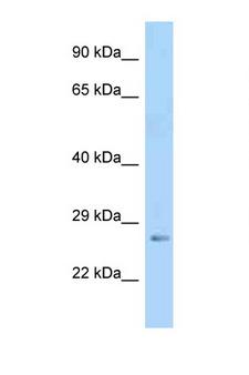 IGFBP5 Antibody - IGFBP5 antibody Western blot of Mouse Pancreas lysate. Antibody concentration 1 ug/ml.  This image was taken for the unconjugated form of this product. Other forms have not been tested.