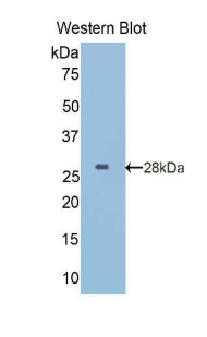 IGFBP5 Antibody - Western blot of recombinant IGFBP5 / IGFBP-5.  This image was taken for the unconjugated form of this product. Other forms have not been tested.
