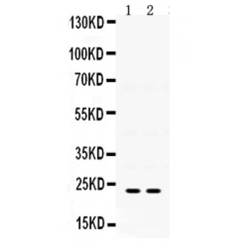 IGFBP5 Antibody - IGFBP5 antibody Western blot. All lanes: Anti IGFBP5 at 0.5 ug/ml. Lane 1: U20S Whole Cell Lysate at 40 ug. Lane 2: HELA Whole Cell Lysate at 40 ug. Predicted band size: 23 kD. Observed band size: 23 kD.