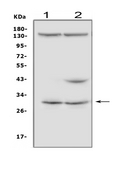 IGFBP5 Antibody - Western blot analysis of IGFBP5 using anti-IGFBP5 antibody. Electrophoresis was performed on a 5-20% SDS-PAGE gel at 70V (Stacking gel) / 90V (Resolving gel) for 2-3 hours. The sample well of each lane was loaded with 50ug of sample under reducing conditions. Lane 1: human PC-3 whole cell lysates, Lane 2: human Hela whole cell lysates. After Electrophoresis, proteins were transferred to a Nitrocellulose membrane at 150mA for 50-90 minutes. Blocked the membrane with 5% Non-fat Milk/ TBS for 1.5 hour at RT. The membrane was incubated with rabbit anti-IGFBP5 antigen affinity purified polyclonal antibody at 0.5 µg/mL overnight at 4°C, then washed with TBS-0.1% Tween 3 times with 5 minutes each and probed with a goat anti-rabbit IgG-HRP secondary antibody at a dilution of 1:10000 for 1.5 hour at RT. The signal is developed using an Enhanced Chemiluminescent detection (ECL) kit with Tanon 5200 system. A specific band was detected for IGFBP5 at approximately 31KD. The expected band size for IGFBP5 is at 31KD.