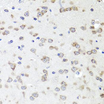 IGFBP5 Antibody - Immunohistochemistry of paraffin-embedded mouse brain using IGFBP5 antibody at dilution of 1:100 (40x lens).