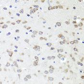 IGFBP5 Antibody - Immunohistochemistry of paraffin-embedded mouse brain using IGFBP5 antibody at dilution of 1:100 (40x lens).