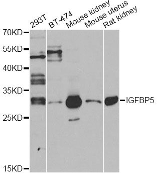 IGFBP5 Antibody - Western blot analysis of extracts of various cell lines, using IGFBP5 antibody at 1:1000 dilution. The secondary antibody used was an HRP Goat Anti-Rabbit IgG (H+L) at 1:10000 dilution. Lysates were loaded 25ug per lane and 3% nonfat dry milk in TBST was used for blocking. An ECL Kit was used for detection and the exposure time was 30s.