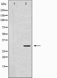 IGFBP5 Antibody - Western blot analysis of extracts of HEK293T cells using IGFBP5 antibody. The lane on the left is treated with the antigen-specific peptide.