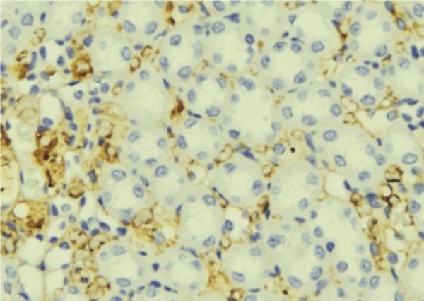 IGFBP5 Antibody - 1:100 staining mouse liver tissue by IHC-P. The sample was formaldehyde fixed and a heat mediated antigen retrieval step in citrate buffer was performed. The sample was then blocked and incubated with the antibody for 1.5 hours at 22°C. An HRP conjugated goat anti-rabbit antibody was used as the secondary.
