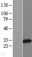 IGFBP5 Protein - Western validation with an anti-DDK antibody * L: Control HEK293 lysate R: Over-expression lysate