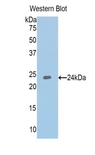 IGFBP6 Antibody - Western blot of recombinant IGFBP6 / IGFBP-6.  This image was taken for the unconjugated form of this product. Other forms have not been tested.