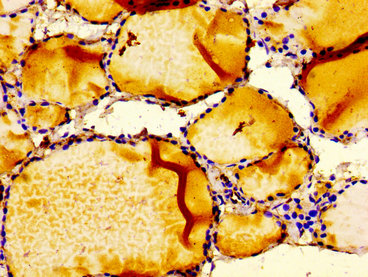 IGFBP6 Antibody - Immunohistochemistry image of paraffin-embedded human thyroid tissue at a dilution of 1:100