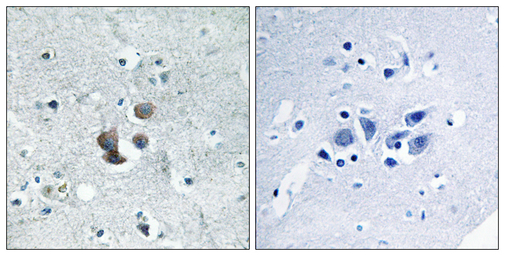 IGFBP7 / TAF Antibody - Immunohistochemistry analysis of paraffin-embedded human brain tissue, using IBP7 Antibody. The picture on the right is blocked with the synthesized peptide.