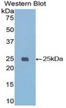 IGFBP7 / TAF Antibody - Western blot of recombinant IGFBP7 / TAF.  This image was taken for the unconjugated form of this product. Other forms have not been tested.