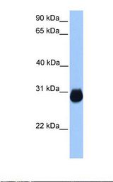 IGFBP7 / TAF Antibody - Fetal muscle lysate. Antibody concentration: 1.0 ug/ml. Gel concentration: 12%.  This image was taken for the unconjugated form of this product. Other forms have not been tested.