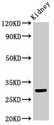 IGFBP7 / TAF Antibody - Western Blot Positive WB detected in: Rat kidney tissue All lanes: IGFBP7 antibody at 3.4µg/ml Secondary Goat polyclonal to rabbit IgG at 1/50000 dilution Predicted band size: 30, 29 kDa Observed band size: 30 kDa