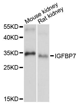 IGFBP7 / TAF Antibody - Western blot analysis of extracts of various cell lines, using IGFBP7 antibody at 1:1000 dilution. The secondary antibody used was an HRP Goat Anti-Rabbit IgG (H+L) at 1:10000 dilution. Lysates were loaded 25ug per lane and 3% nonfat dry milk in TBST was used for blocking. An ECL Kit was used for detection and the exposure time was 90s.