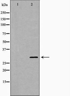IGFBP7 / TAF Antibody - Western blot analysis of extracts of mouse brain tissue lysate using IGFBP7 antibody. The lane on the left is treated with the antigen-specific peptide.