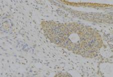 IGFBP7 / TAF Antibody - 1:100 staining human uterus tissue by IHC-P. The sample was formaldehyde fixed and a heat mediated antigen retrieval step in citrate buffer was performed. The sample was then blocked and incubated with the antibody for 1.5 hours at 22°C. An HRP conjugated goat anti-rabbit antibody was used as the secondary.