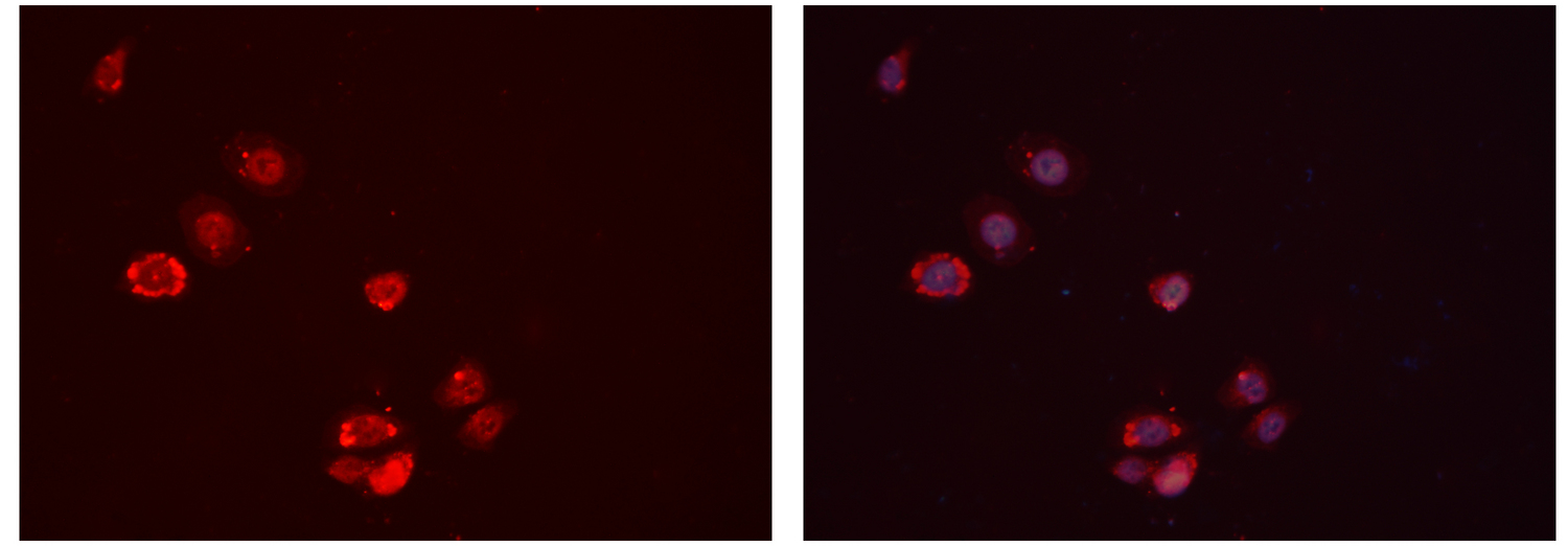 IGFBP7 / TAF Antibody - Staining HeLa cells by IF/ICC. The samples were fixed with PFA and permeabilized in 0.1% Triton X-100, then blocked in 10% serum for 45 min at 25°C. The primary antibody was diluted at 1:200 and incubated with the sample for 1 hour at 37°C. An Alexa Fluor 594 conjugated goat anti-rabbit IgG (H+L) antibody, diluted at 1/600 was used as secondary antibody.