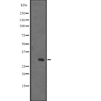 IGFBPL1 Antibody - Western blot analysis of IGFBPL1 expression in human fetal liver tissue lysate. The lane on the left is treated with the antigen-specific peptide.