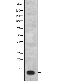 IGFL1 Antibody - Western blot analysis of IGFL1 expression in HeLa cells lysate. The lane on the left is treated with the antigen-specific peptide.