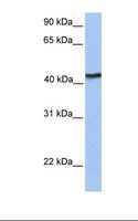 IGFLR1 / TMEM149 Antibody - Fetal brain lysate. Antibody concentration: 1.0 ug/ml. Gel concentration: 12%.  This image was taken for the unconjugated form of this product. Other forms have not been tested.