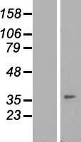 IGFLR1 / TMEM149 Protein - Western validation with an anti-DDK antibody * L: Control HEK293 lysate R: Over-expression lysate