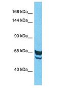 IGFN1 Antibody - IGFN1 antibody Western Blot of HepG2. Antibody dilution: 1 ug/ml.  This image was taken for the unconjugated form of this product. Other forms have not been tested.