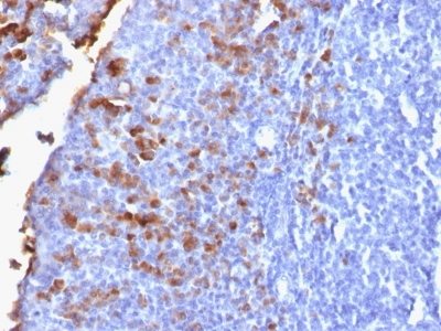 IgG Heavy Chain Antibody - Formalin-fixed, paraffin-embedded human Tonsil stained with IgG Rabbit Recombinant Monoclonal Antibody (IG1707R).