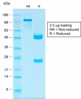 IgG Heavy Chain Antibody - SDS-PAGE Analysis Purified IgG Rabbit Recombinant Monoclonal Antibody (IG1707R). Confirmation of Purity and Integrity of Antibody.