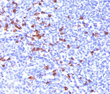 IgG Heavy Chain Antibody - IgG Heavy Chain antibody IG266 immunohistochemistry tonsil.  This image was taken for the unmodified form of this product. Other forms have not been tested.