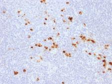 IgG Heavy Chain Antibody - Formalin-fixed, paraffin-embedded human Tonsil stained with IgG Rabbit Recombinant Monoclonal Antibody (IG507R).