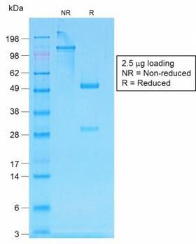 IgG Heavy Chain Antibody - SDS-PAGE Analysis Purified IgG Rabbit Recombinant Monoclonal Antibody (IG507R). Confirmation of Purity and Integrity of Antibody.