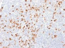 IgG Heavy Chain Antibody - Formalin-fixed, paraffin-embedded human Tonsil stained with IgG Mouse Recombinant Monoclonal Antibody (rIG266).