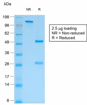 IgG Heavy Chain Antibody - SDS-PAGE Analysis Purified IgG Mouse Recombinant Monoclonal Antibody (rIG266). Confirmation of Purity and Integrity of Antibody.