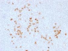 IgG Heavy Chain Antibody - IHC testing of human tonsil and IgG antibody. Required HIER: boil tissue sections in 10mM citrate buffer, pH 6, for 10-20 min followed by cooling at RT for 20 min.