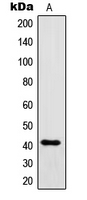 IgG1 Antibody - Western blot analysis of IgG1 expression in IgG recombinant protein (A).