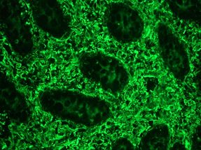 IgG1 + IgG2a + IgG2b + IgG3 Antibody - GAM/IgG(H+L)/FITC was used in a 1:100 dilution on swine colon, in combination with the primary monoclonal antibody to vimentin, RV202 (Vimentin), used in a 1:1000 dilution. The green staining shows the connective tissue cells, while no staining is seen in the epithelial cells of the intestinal crypts.