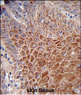 IGHA1 / IgA1 Antibody - Formalin-fixed and paraffin-embedded human skin reacted with IGH Antibody (C-Term), which was peroxidase-conjugated to the secondary antibody, followed by DAB staining. This data demonstrates the use of this antibody for immunohistochemistry; clinical relevance has not been evaluated.