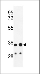 IGHA1 / IgA1 Antibody - Western blot analysis of IGH Antibody (C-Term) in HL-60, A2058 cell line lysates (35ug/lane). IGH (arrow) was detected using the purified Pab.