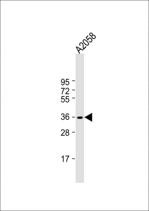 IGHA1 / IgA1 Antibody - Anti-IGH Antibody (C-Term) at 1:1000 dilution + A2058 whole cell lysate Lysates/proteins at 20 µg per lane. Secondary Goat Anti-Rabbit IgG, (H+L), Peroxidase conjugated at 1/10000 dilution. Predicted band size: 38 kDa Blocking/Dilution buffer: 5% NFDM/TBST.