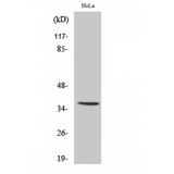 IGHA1 / IgA1 Antibody - Western blot of IgA antibody