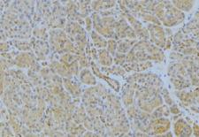 IGHA1 / IgA1 Antibody - 1:100 staining human pancreas tissue by IHC-P. The sample was formaldehyde fixed and a heat mediated antigen retrieval step in citrate buffer was performed. The sample was then blocked and incubated with the antibody for 1.5 hours at 22°C. An HRP conjugated goat anti-rabbit antibody was used as the secondary.
